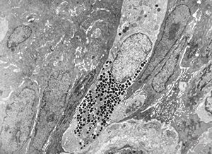 Kulchitsky enteroendocrine cell